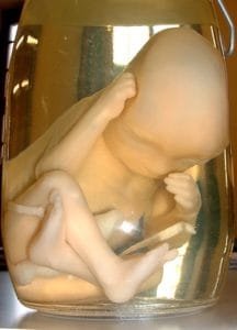 Human Fetus