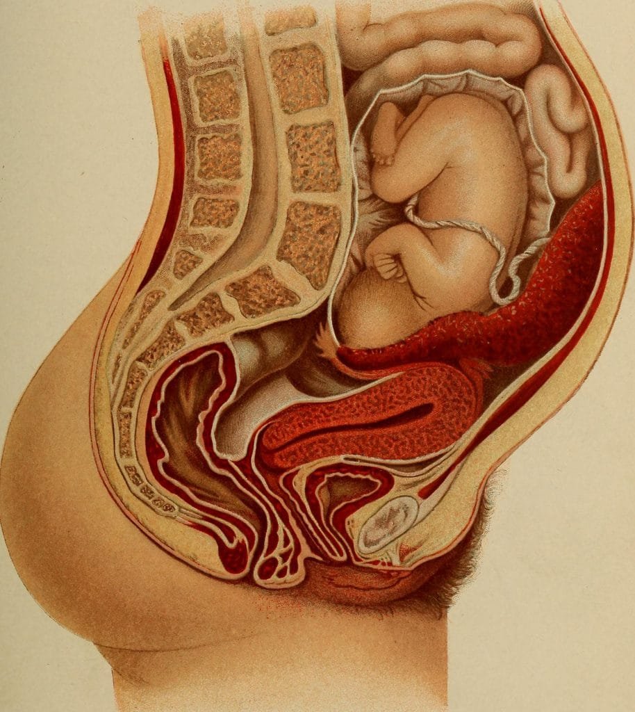 Muerte fetal intrauterina