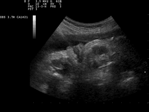 Ultrasound Scan ND 0103111808 1124150