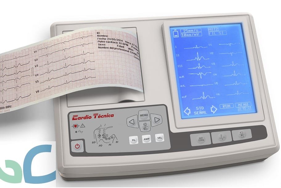 ¿Qué elementos se utilizan en un Electrocardiograma?