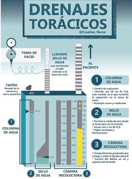 Drenaje torácico y técnicas de enfermería