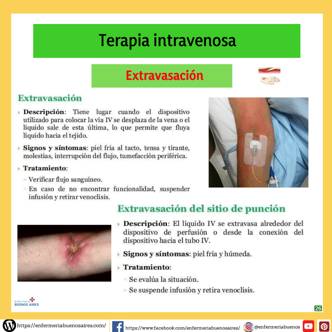 Terapia intravenosa26