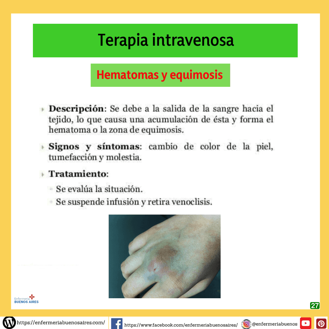 Complicaciones en la Terapia Intravenosa