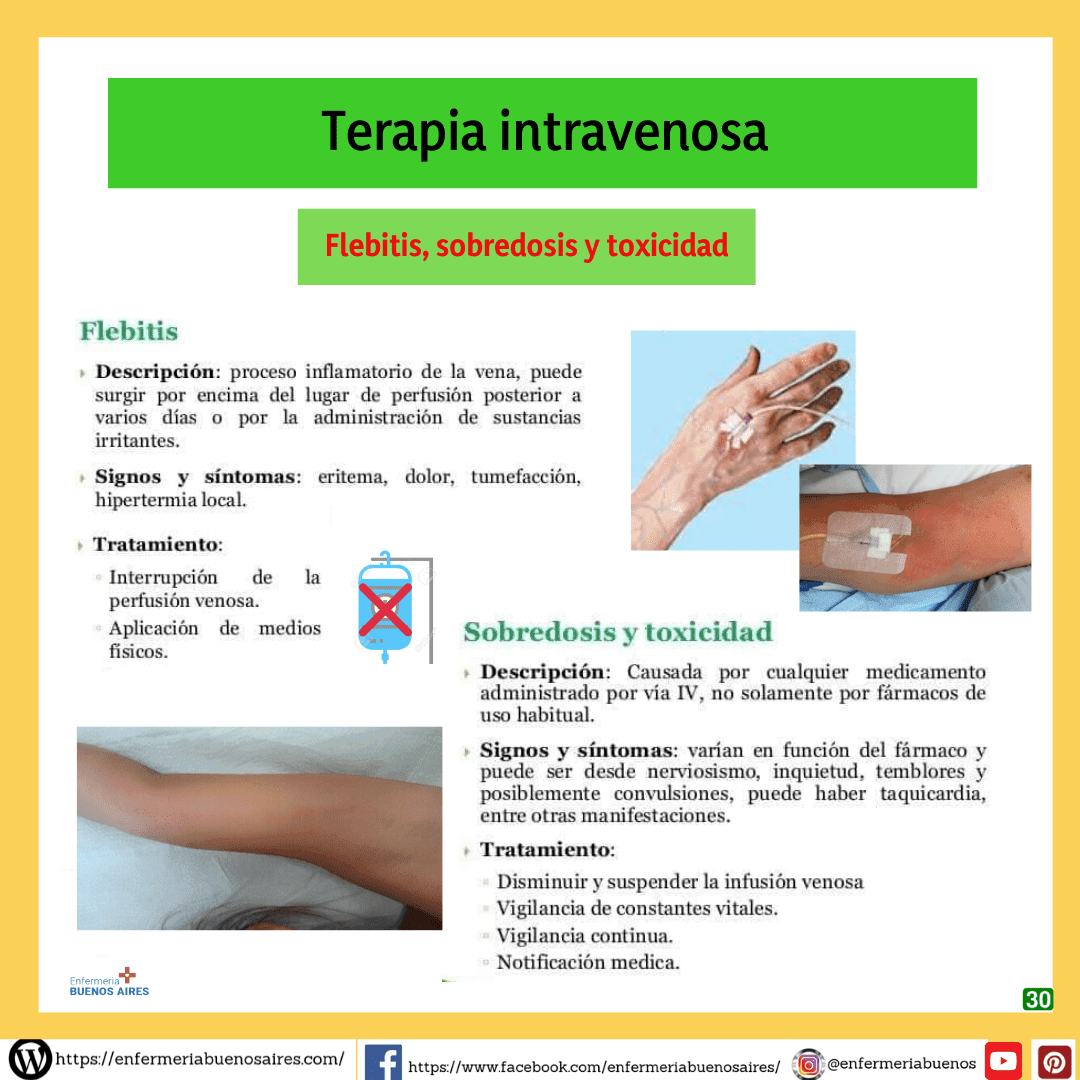 Terapia intravenosa30