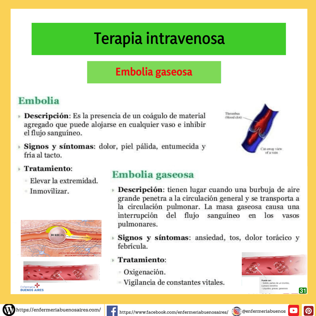Terapia intravenosa31