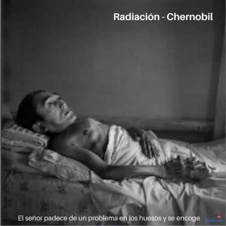 ¿Qué efectos produce la radiación nuclear en el cuerpo?